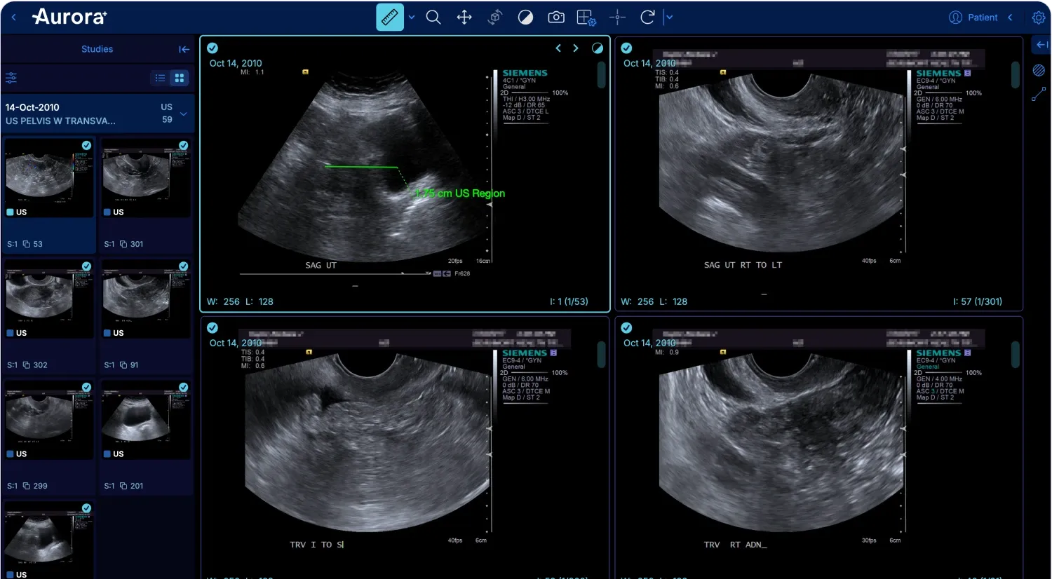 stepsList.PACSRIS.title